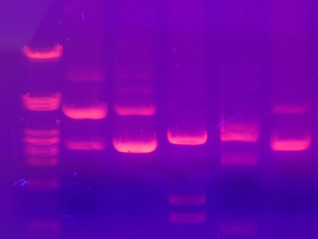etbr-straining-of-DNA-on-gel-with-age